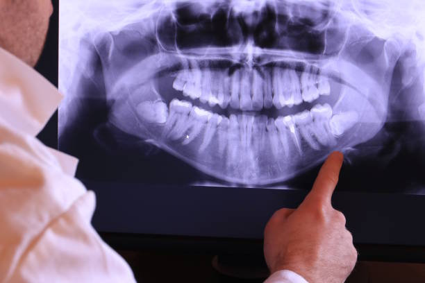 Best Emergency Care for Gum Disease in Wynnewood, OK